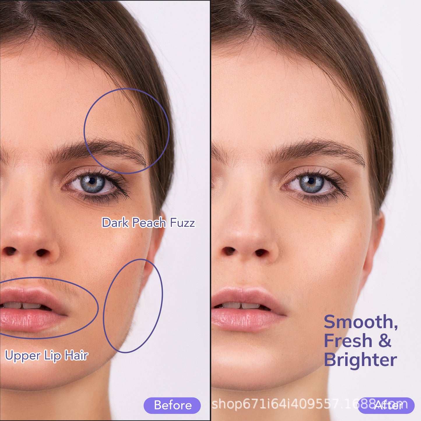 GlowPlaner - LED Dermaplaner