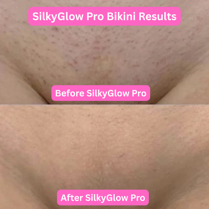 SilkyGlow Pro - Finally, a pain-free shave for sensitive skin ✨