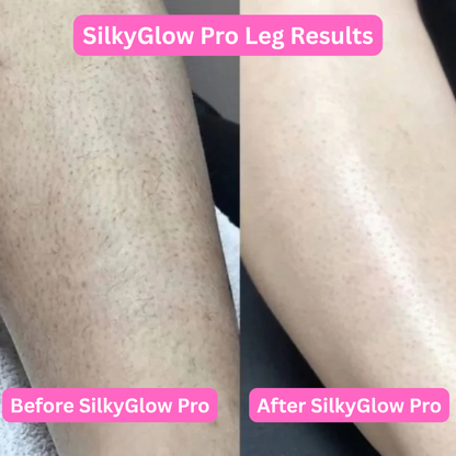 SilkyGlow Pro - Finally, a pain-free shave for sensitive skin ✨