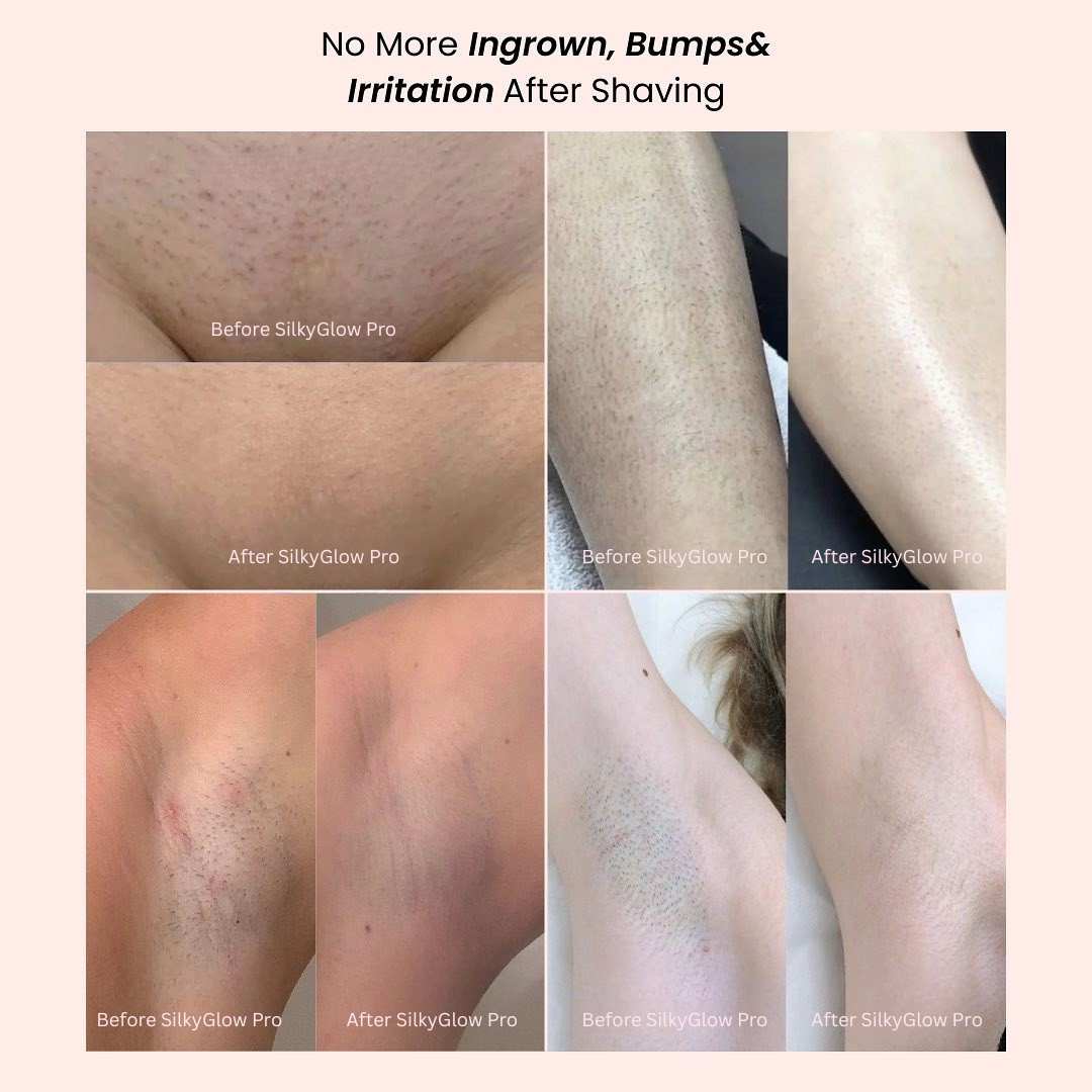 Black Friday Sale - SilkyGlow Pro - Finally, a pain-free shave for sensitive skin ✨