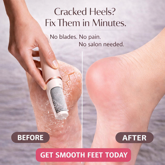 SilkySole™ - Visibly Smoother Heels From First Use