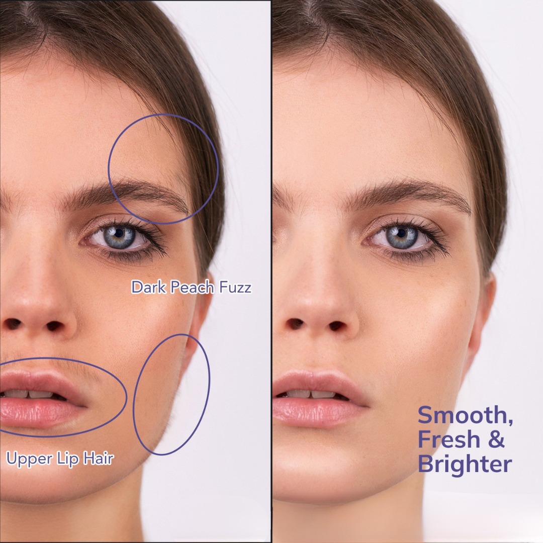 DermaGlow- Ultrasonic LED Facial Dermaplaner